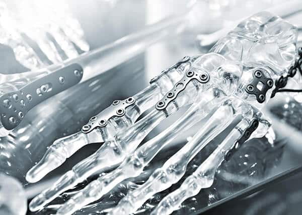 Laser cutting medical technology high precision cutting of titanium and nitinol implants